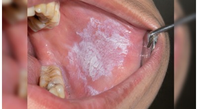 Management of Facial & Oral Soft-Tissue Lesions illustration